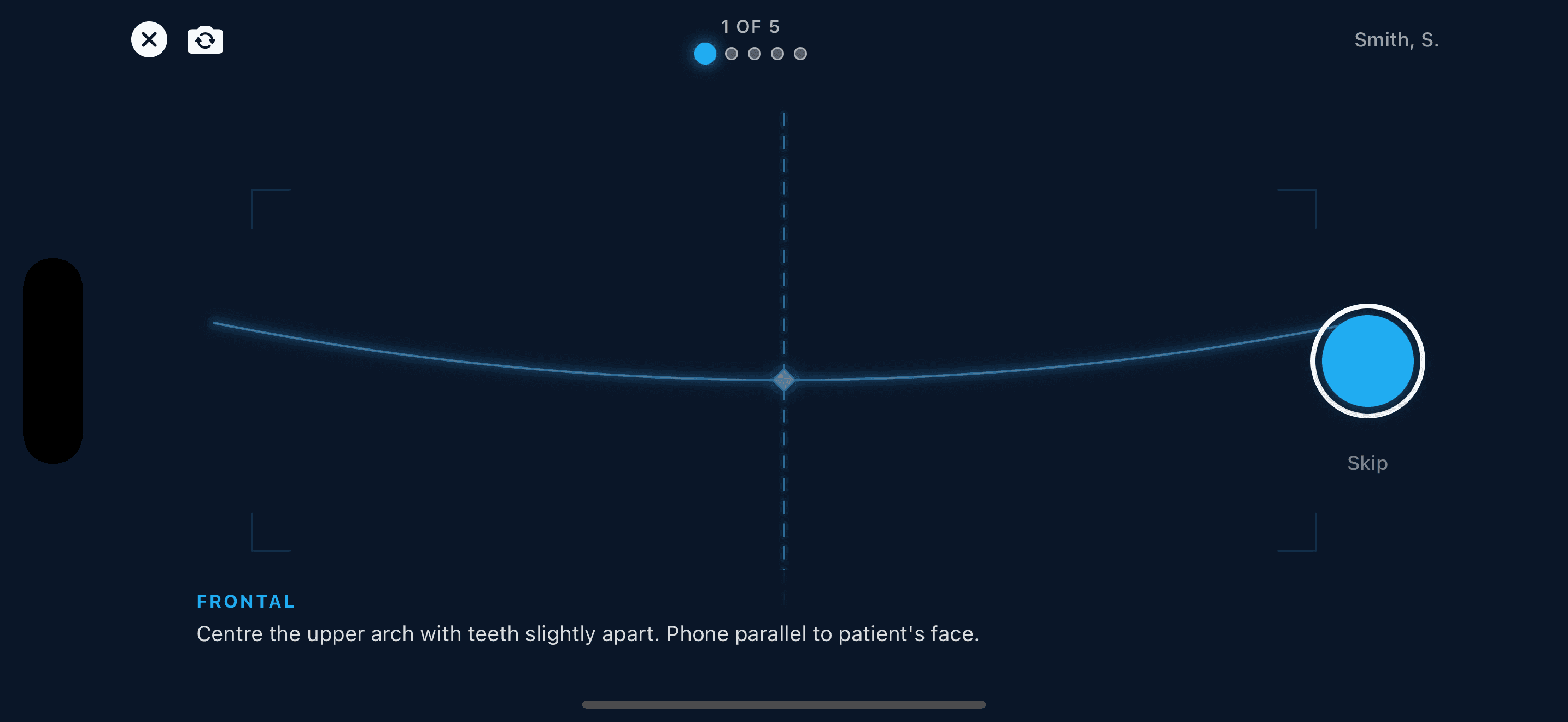Okare Mobile — guided intraoral photo capture flow
